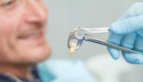 Extractions - Warsaw Smile Dental